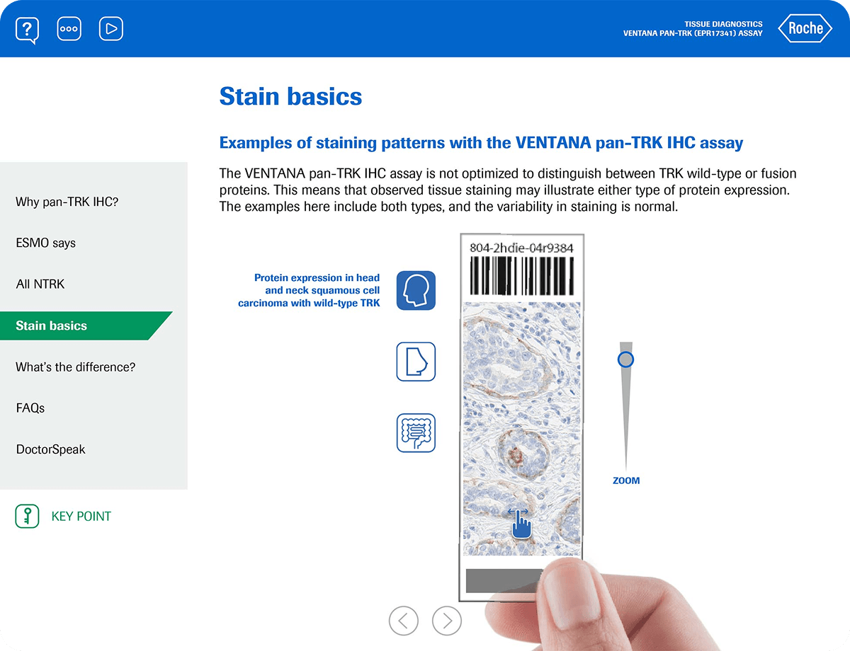 Pan-TRK Carousel Image 2