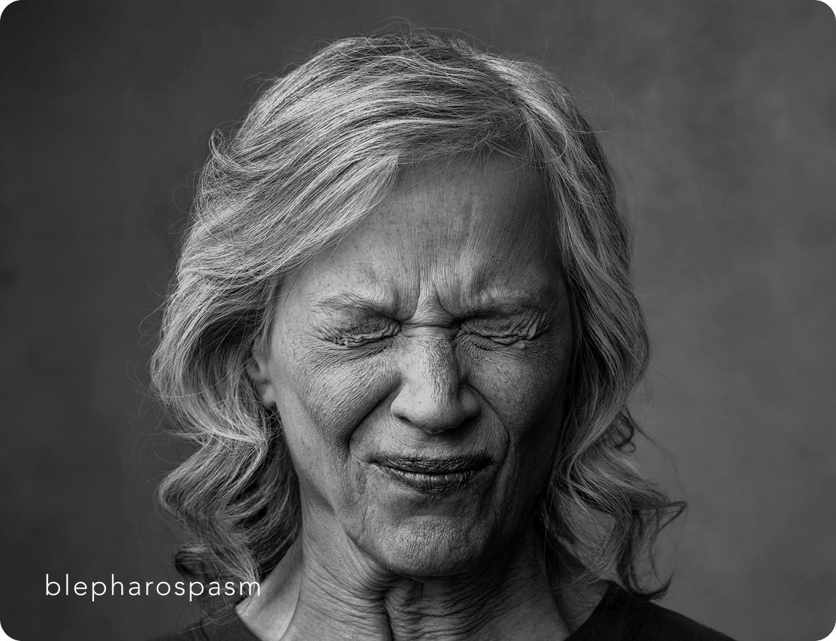 Xeomin Fight of a Lifetime Carousel Image 1