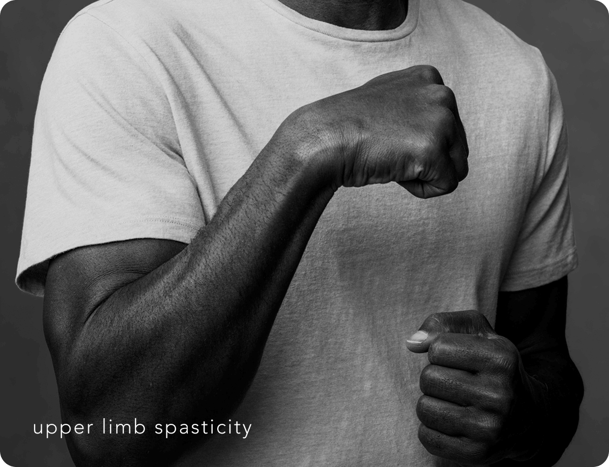 Xeomin Fight of a Lifetime Carousel Image 2