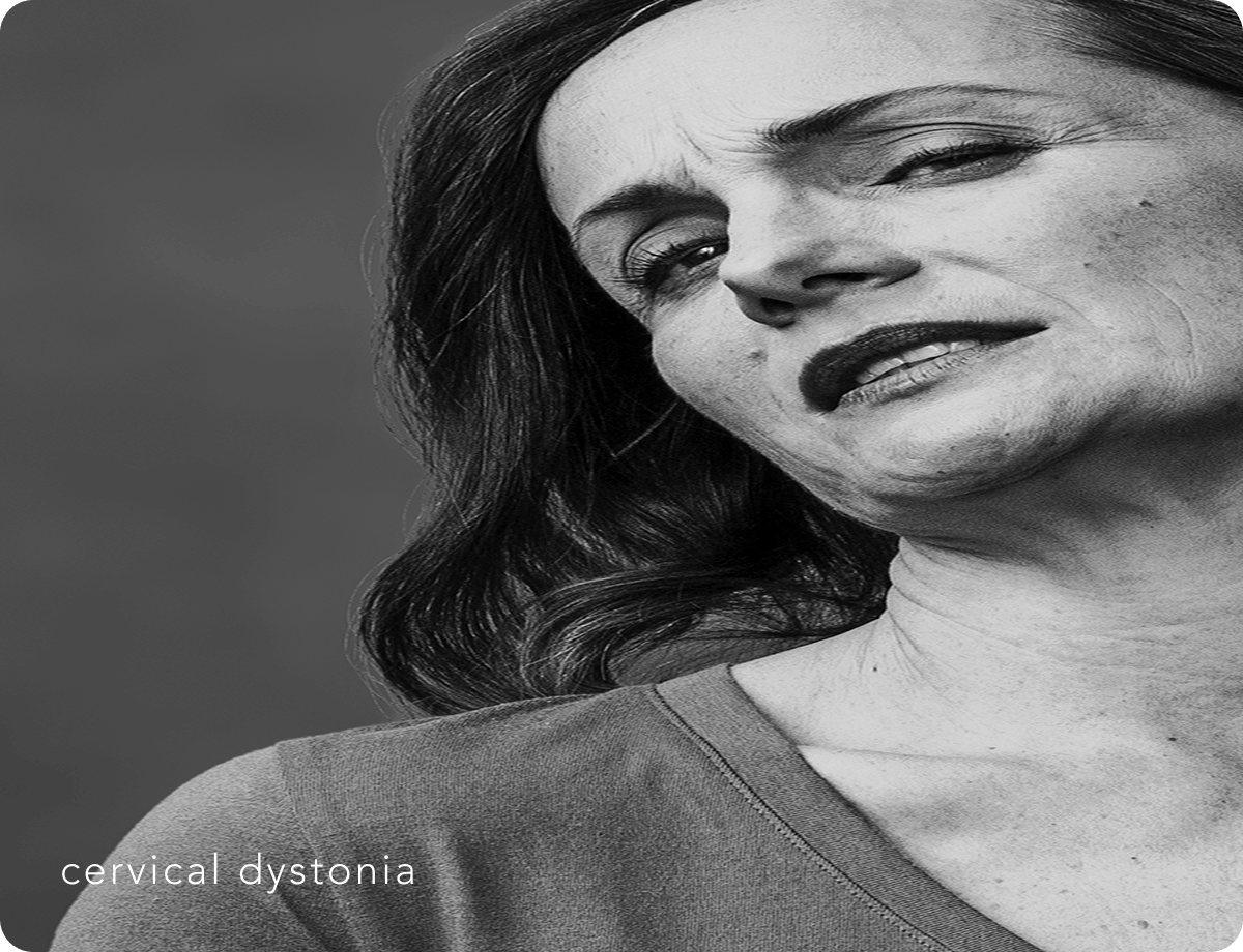 Xeomin Fight of a Lifetime Carousel Image 3